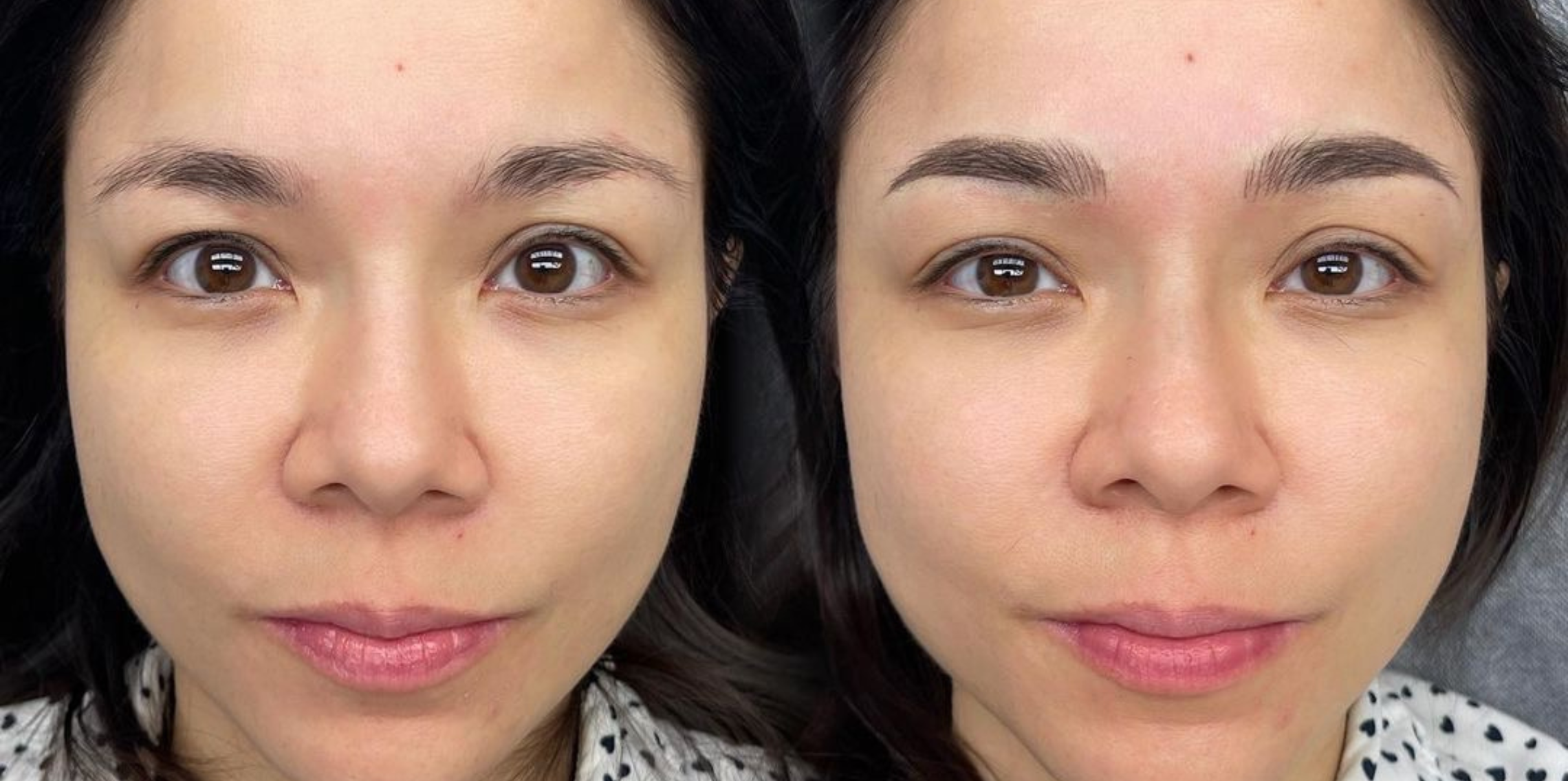 Combo Brow Microblading in Los Angeles