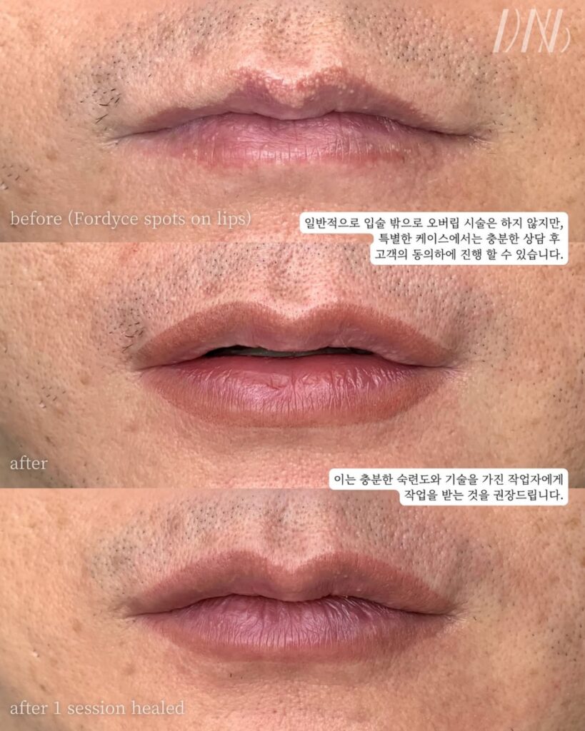 Fog Lip Blush - Before and After - Lip Blush PMU Class in Los Angeles