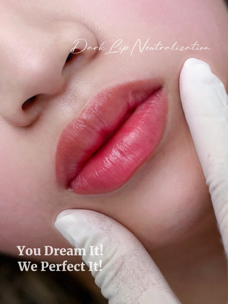 Dark Lip Neutralization in Los Angeles - Sunny Brow