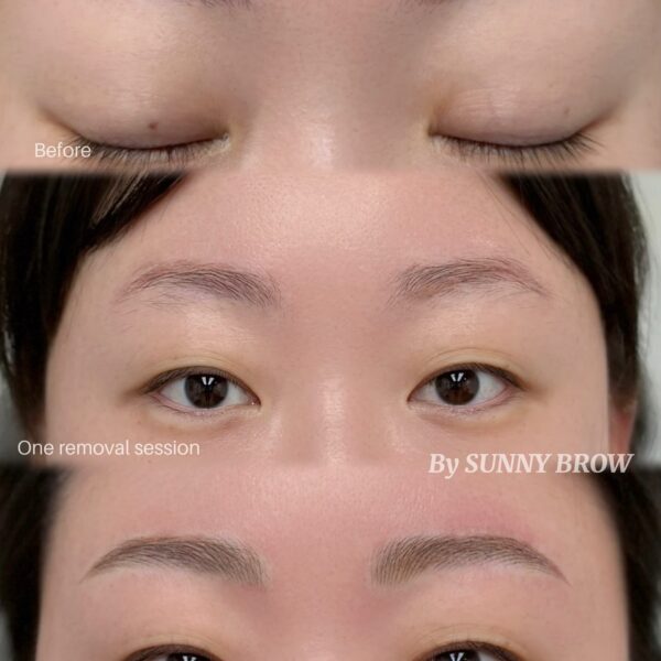 Old Eyebrow Removal Service in Los Angeles - Sunny Brow