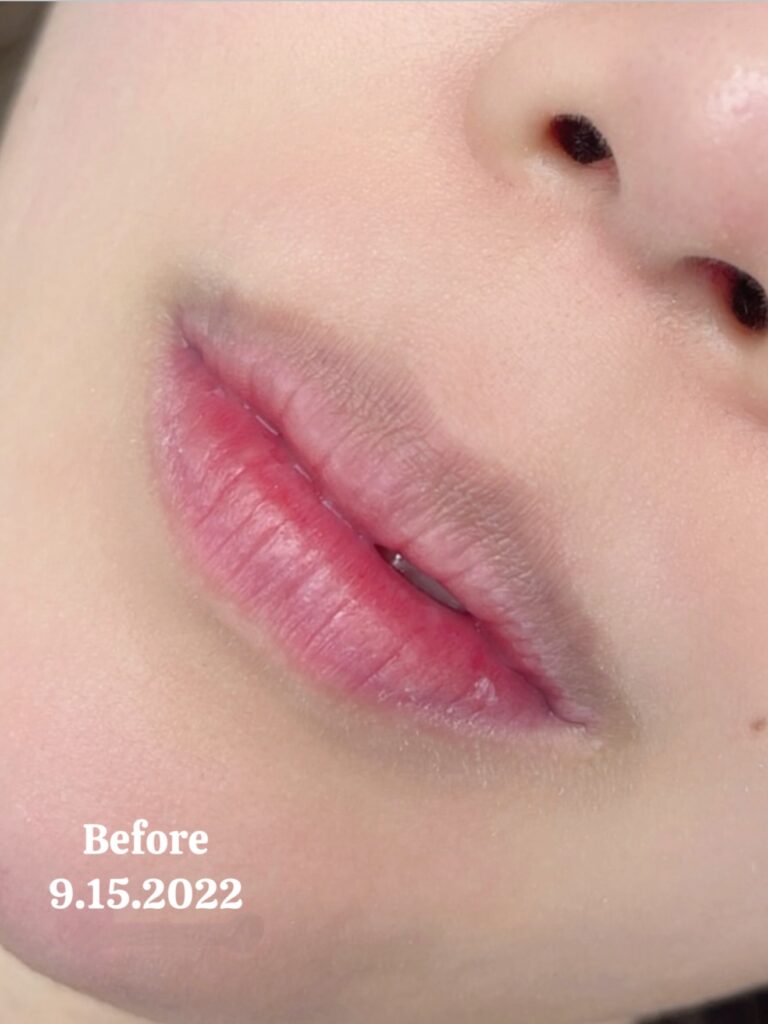 Sunny Brow - Before Lip Blush in Los Angeles