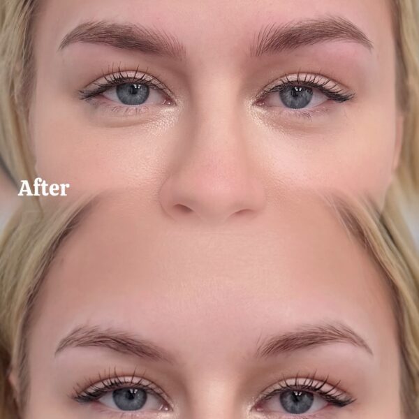 Nano Brows - Before and after - Sunny Brow in Los Angeles