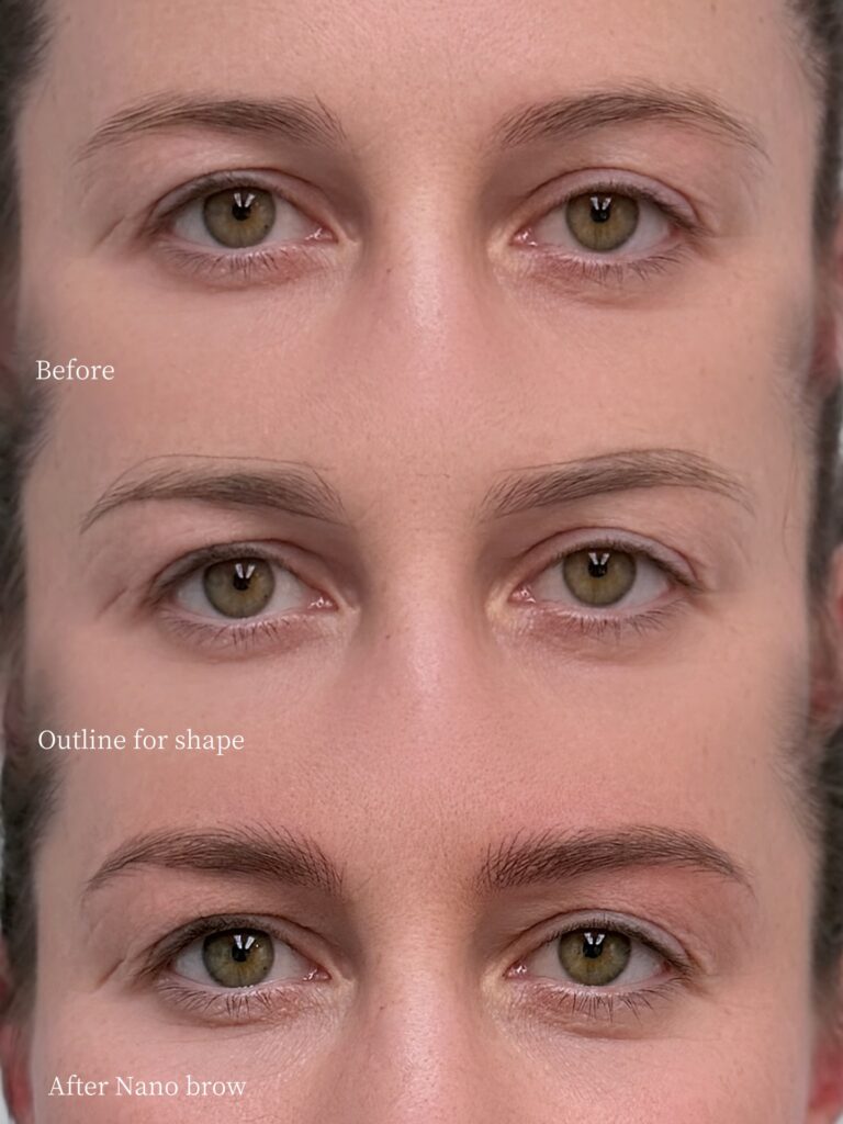 Step-by-step nano brow process showing before, outline mapping, and finished hair-stroke results at Sunnybrow LA
