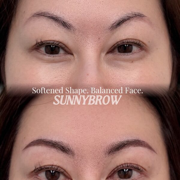 Combo brows correction result in Los Angeles by Sunny Brow