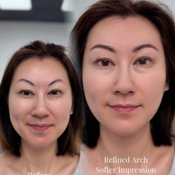 Combo brows correction result in Los Angeles by Sunny Brow