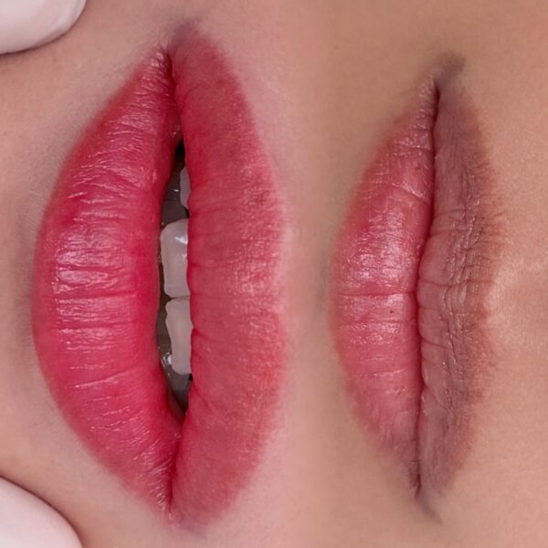 Dark Lip Neutralization - Lip Blush at Sunny Brow in Los Angeles