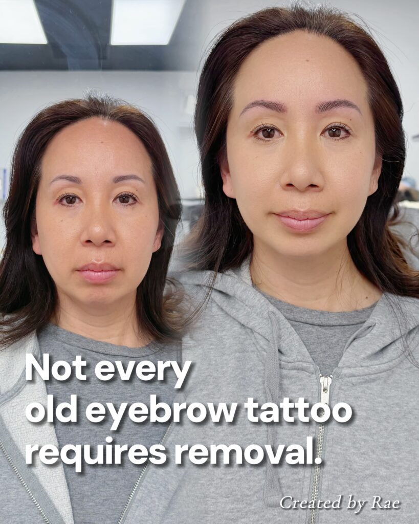 Before and after nano brows correcting an old eyebrow tattoo, front view in Los Angeles
