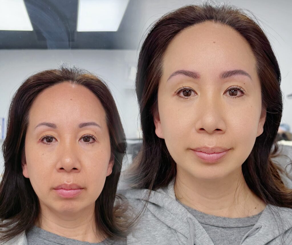 Before and after nano brows correcting an old eyebrow tattoo, in Los Angeles