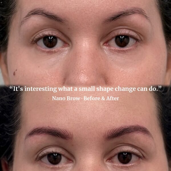 Nano brows high arch correction before and after at Sunny Brow Los Angeles